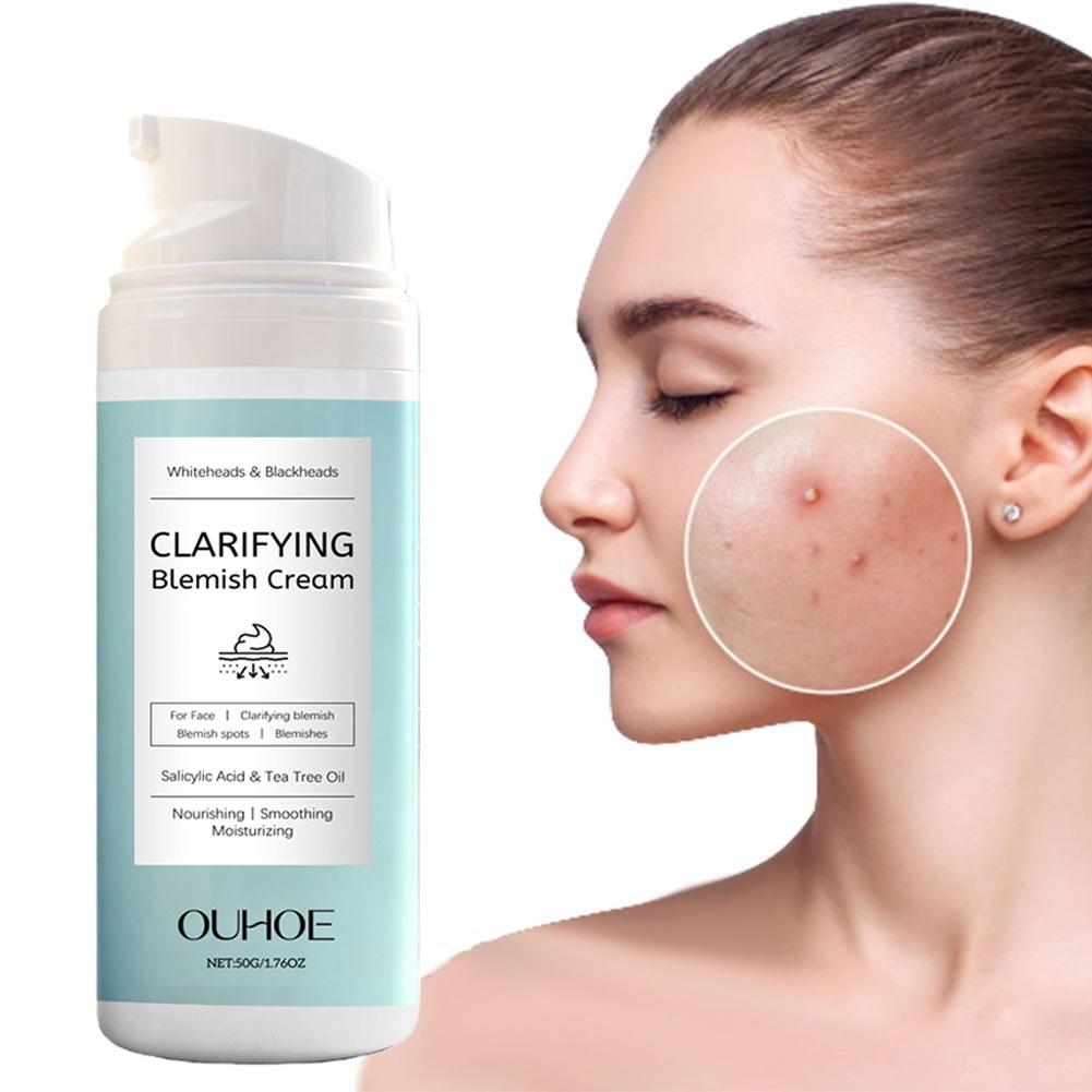 Salicylic Acid Blackhead Remover - Crema all'Acido Salicilico per Rimuovere l'Acne,